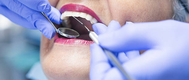 Best Emergency Dental Care for Abscessed Tooth in Sunbury, OH